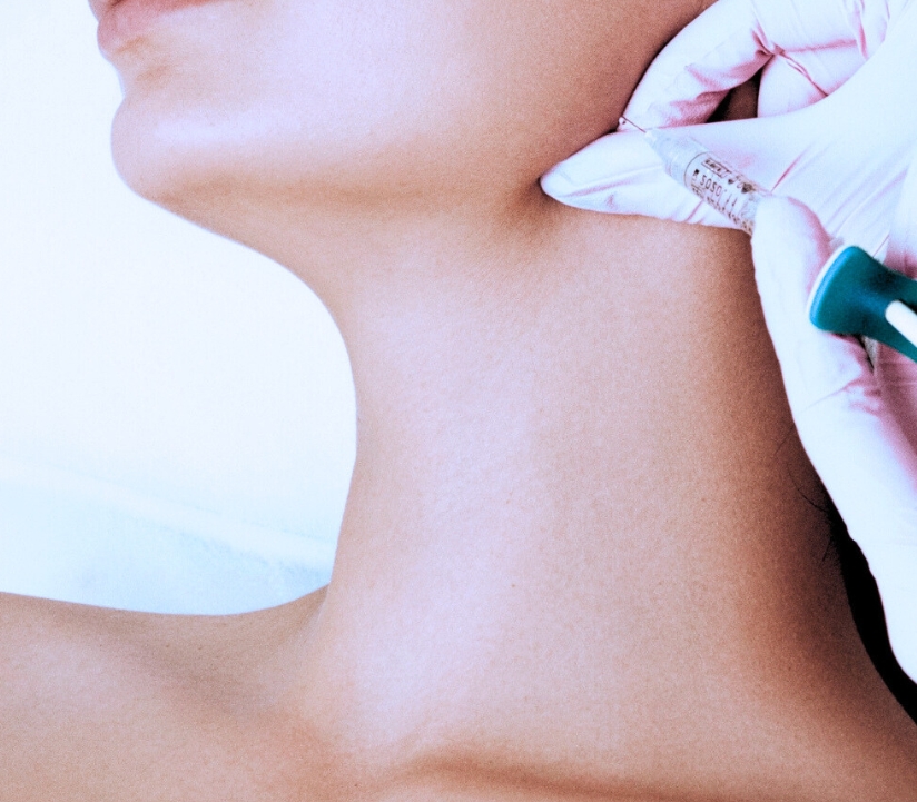 sagging skin patient being treated